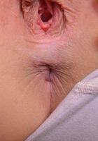 ATK Premium: Alaina Dawson (Alaina Dawson Gapes Her Pussy and Ass)