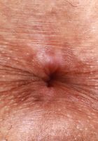 ATK Petites: Alexis Tae (Alexis Tae in amateur)