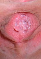 ATK Galleria: Alison De Vore (Alison spreads her tight pink meat)