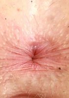 ATK Premium: Alice Moore (Alice Moore Outdoor Strip)