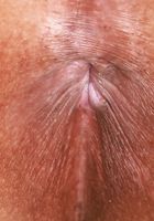 ATK Exotics: Alona Bloom (Alona Bloom Gets Undressed Outdoors)