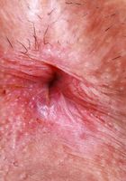 ATK Galleria: Amber Summer (Amber poses in her pink bra and panties.)