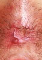 ATK Exotics: Amber Summer (Amber Summer Pink Lingerie)