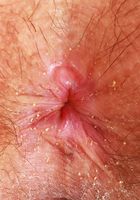 ATK Galleria: Angelica Coralvine (Angelica Coralvine Outdoor Spreading)