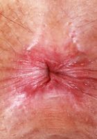 ATK Petites: Angel Windell (Angel Windell Lacy Lingerie Strip)