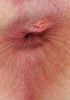 ATK Galleria: Annie Archer (Annie Archer Gaping Spreads)