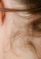 ATK Natural & Hairy: Apricot Pitts (Apricot Pitts in young and hairy)