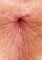 ATK Natural & Hairy: Apricot Pitts (Apricot Pitts Short jeans and Spreads)