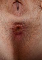 ATK Natural & Hairy: Apricot Pitts (Apricot Pitts in young and hairy)