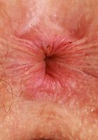 Apricot Pitts from ATK Natural & Hairy