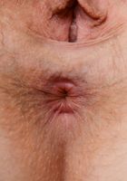 ATK Natural & Hairy: Apricot Pitts (Apricot Pitts in young and hairy)