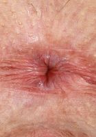 ATK Galleria: April Valentino (April Valentino Spreads out in the Open Air)