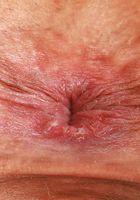 ATK Galleria: Ari Alectra (Ari Alectra Outdoor Strip)