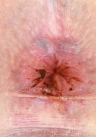 ATK Galleria: Ashley Lane (Ashley Lane Foot Fetish Nudism)