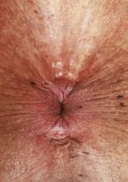 ATK Exotics: Ashlyn Peaks (Ashlyn Peaks Outdoor Lingerie)