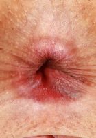 ATK Petites: Asia Rivera (Asia Rivera Dress Spreads)