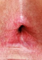 ATK Galleria: Athena Fleurs (Athena Fleurs Outdoor Strip)