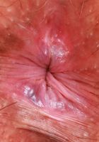 ATK Natural & Hairy: Autumn Berlin (Autumn Berlin Sexy Strip Down)