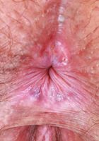 ATK Natural & Hairy: Autumn Berlin (Autumn Berlin No Panties and Pussy Spreading)