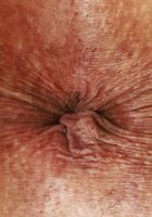 ATK Exotics: Naudi Nala (Naudi Nala Lingerie Outdoors)