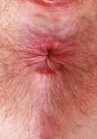 ATK Natural & Hairy: Big Eyes (Big Eyes puts on a show for the lovers of all things hairy)