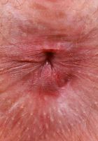 ATK Petites: Big Eyes (Big Eyes is wearing lacey lingerie complete with garters)