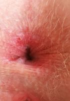 ATK Galleria: Britt Blair (Britt Blair Outdoor Nudes)