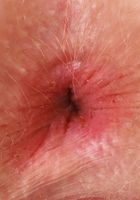 ATK Petites: Britt Blair (Britt Blair Strip and Exposing)