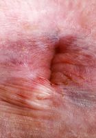 ATK Petites: Celestina Blooms (Celestina Blooms Outside Spreading Pink)