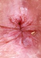 ATK Galleria: Cherry Candle (Cherry is a hot redhead in a yellow dress)