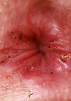 ATK Galleria: Cherry Candle (Cherry Candle lights up your imagination)