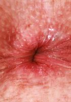 ATK Petites: Chloe Foster (Chloe Foster Upskirt and Pussy Spreading)