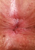 ATK Natural & Hairy: Chloe Kreams (Chloe Kreams Nurse Outfit)