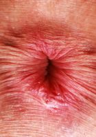 ATK Galleria: Chloe Rose (Chloe Rose Beautiful Pussy Spread)