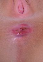 ATK Galleria: Cora Ora (Cora Ora spreads her ass)