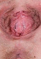 ATK Galleria: Danni Rivers (Danni Rivers in amateur)