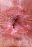 ATK Galleria: Dez Hansen (Dez Hansen is suited up for summer)