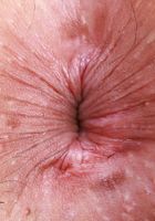 ATK Galleria: Dez Hansen (Dez Hansen strips indoors)