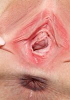 ATK Premium: Dresden (Dresden in amateur)