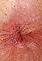 ATK Galleria: Emma Jade (Emma Jade Outdoor Exposure)