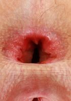 ATK Galleria: Fiona Frost (Fiona Frost Great Gaping in the Open Air)