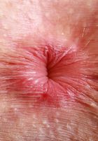 ATK Petites: Fiona Sprouts (Fiona Peaches is happy to see you)