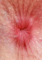 ATK Petites: Fiona Sprouts (Fiona Peaches Watersports)