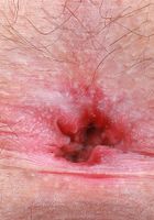 ATK Galleria: Gigi (Gigi in amateur)