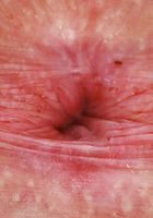 ATK Galleria: Gigi (Gigi Outdoor Strip)