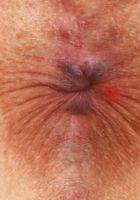 ATK Galleria: Gracie Gates (Gracie Gates Spreads Outdoors)