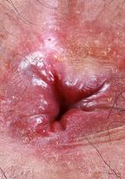 Hazel Heart from ATK Natural & Hairy