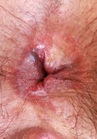 Hazel Heart from ATK Natural & Hairy