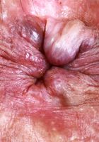 Hazel Heart from ATK Exotics