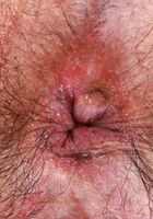 ATK Petites: Hazel Heart (Hazel Heart poses in a sexy little bikini)